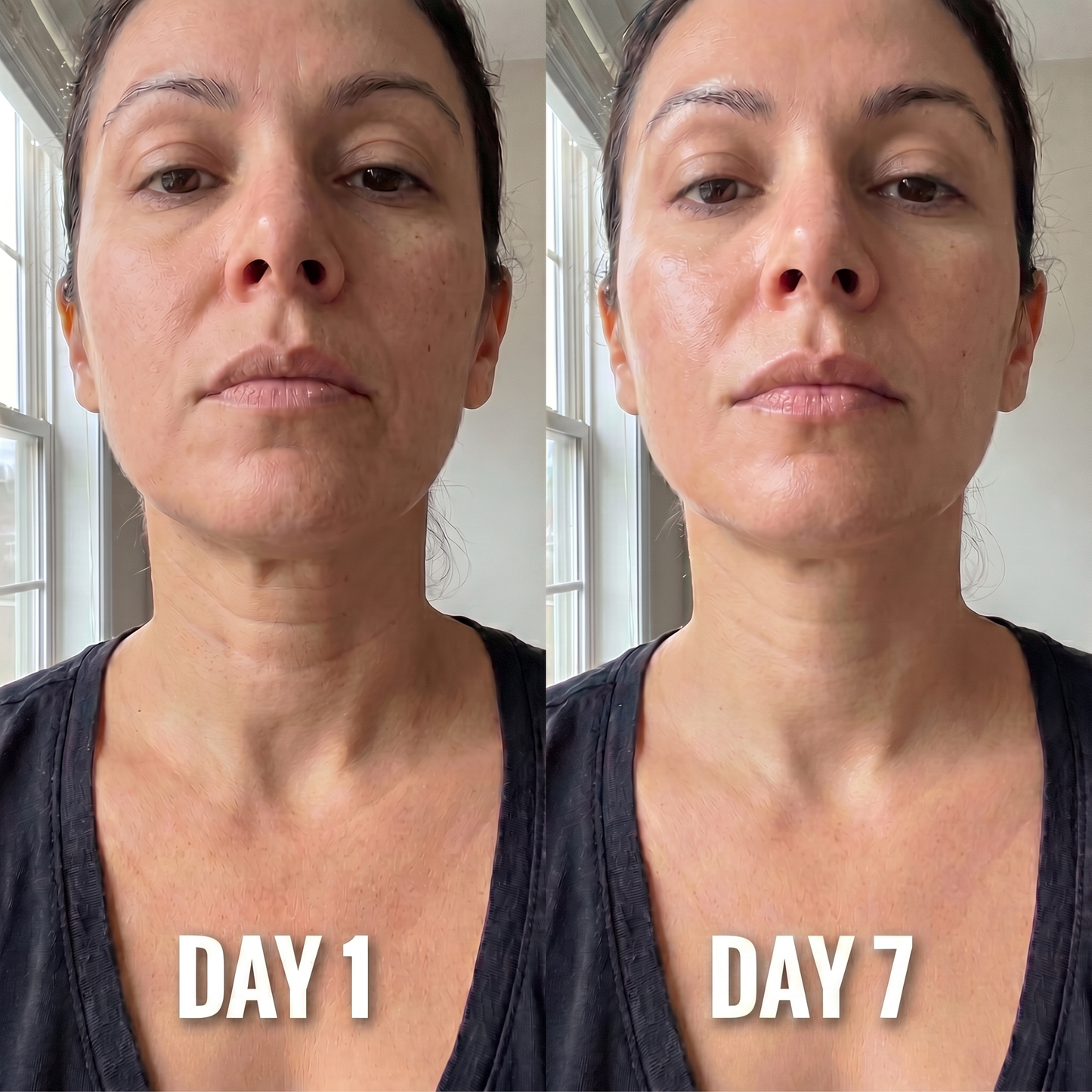Névia™ Collagen Neck Mask