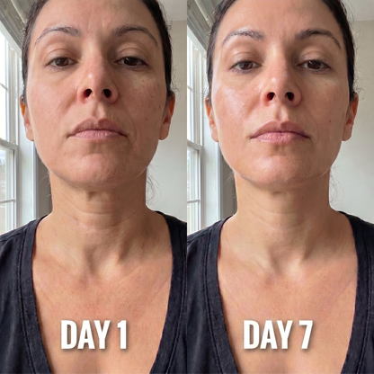 Névia™ Collagen Neck Mask