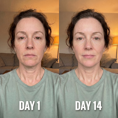 Névia™ Collagen Neck Mask